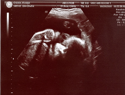 Bean close up Aug 08